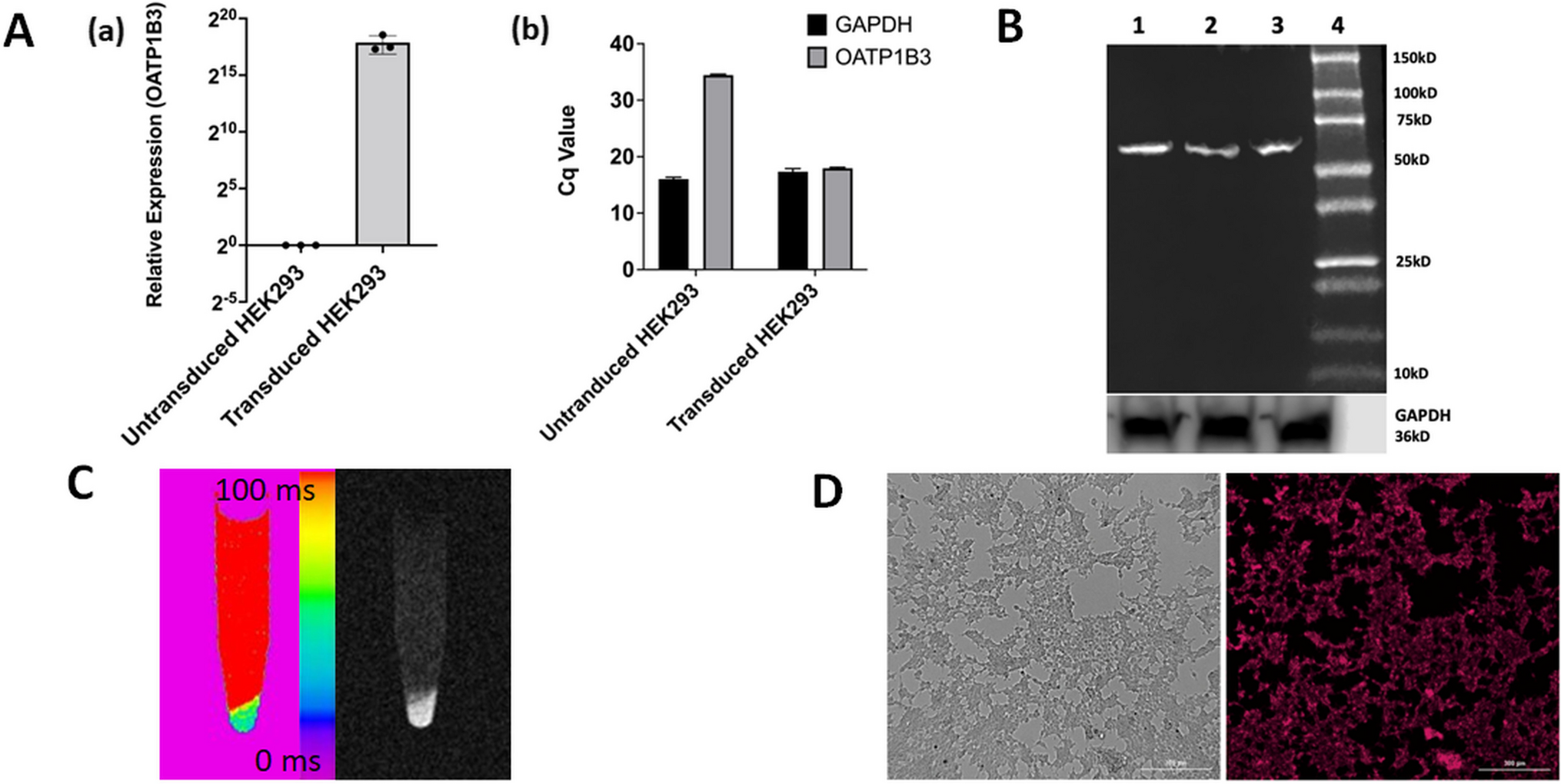MRI-Based Cell Tracking of OATP-Expressing Cell Transplants by Pre-Labeling with Gd-EOB-DTPA