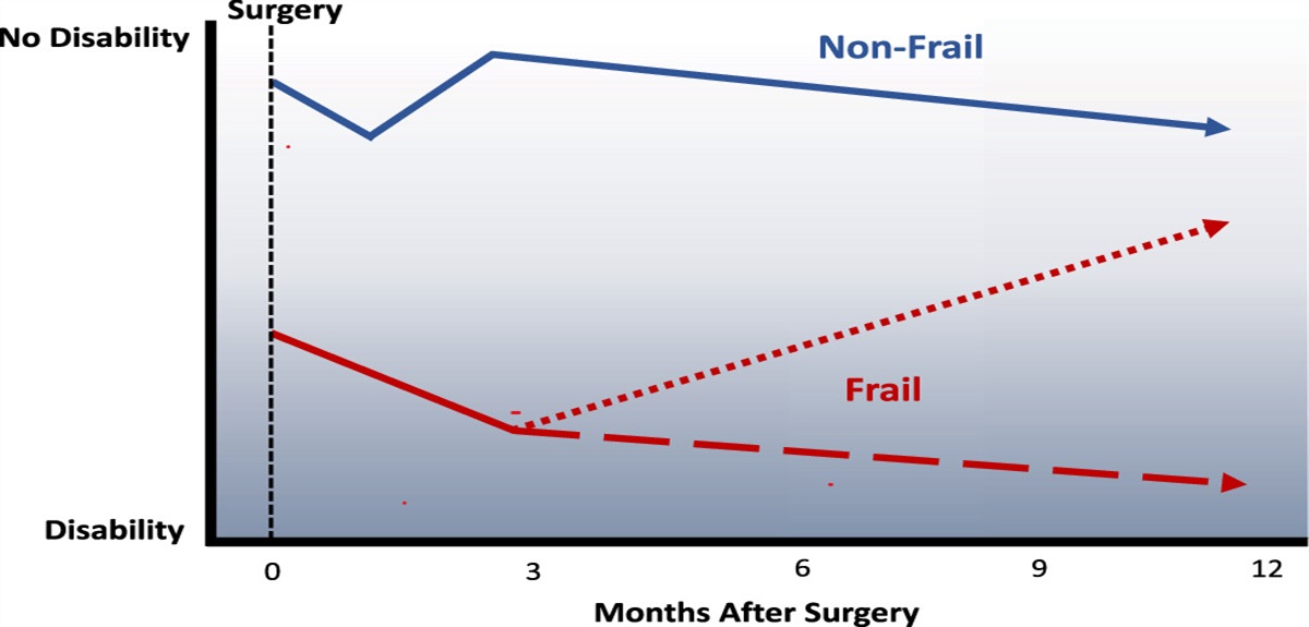 Frailty: Implications for Neuroanesthesia