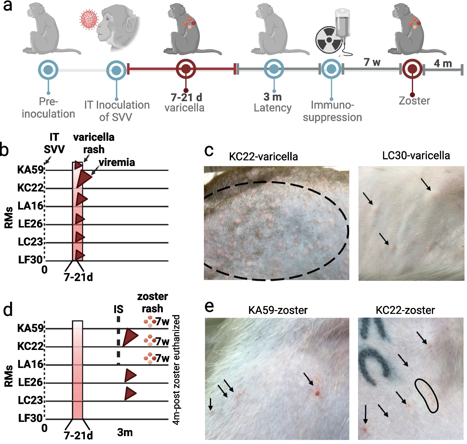 Simian varicella virus infection and reactivation in rhesus macaques trigger cytokine and Aβ40/42 alterations in serum and cerebrospinal fluid