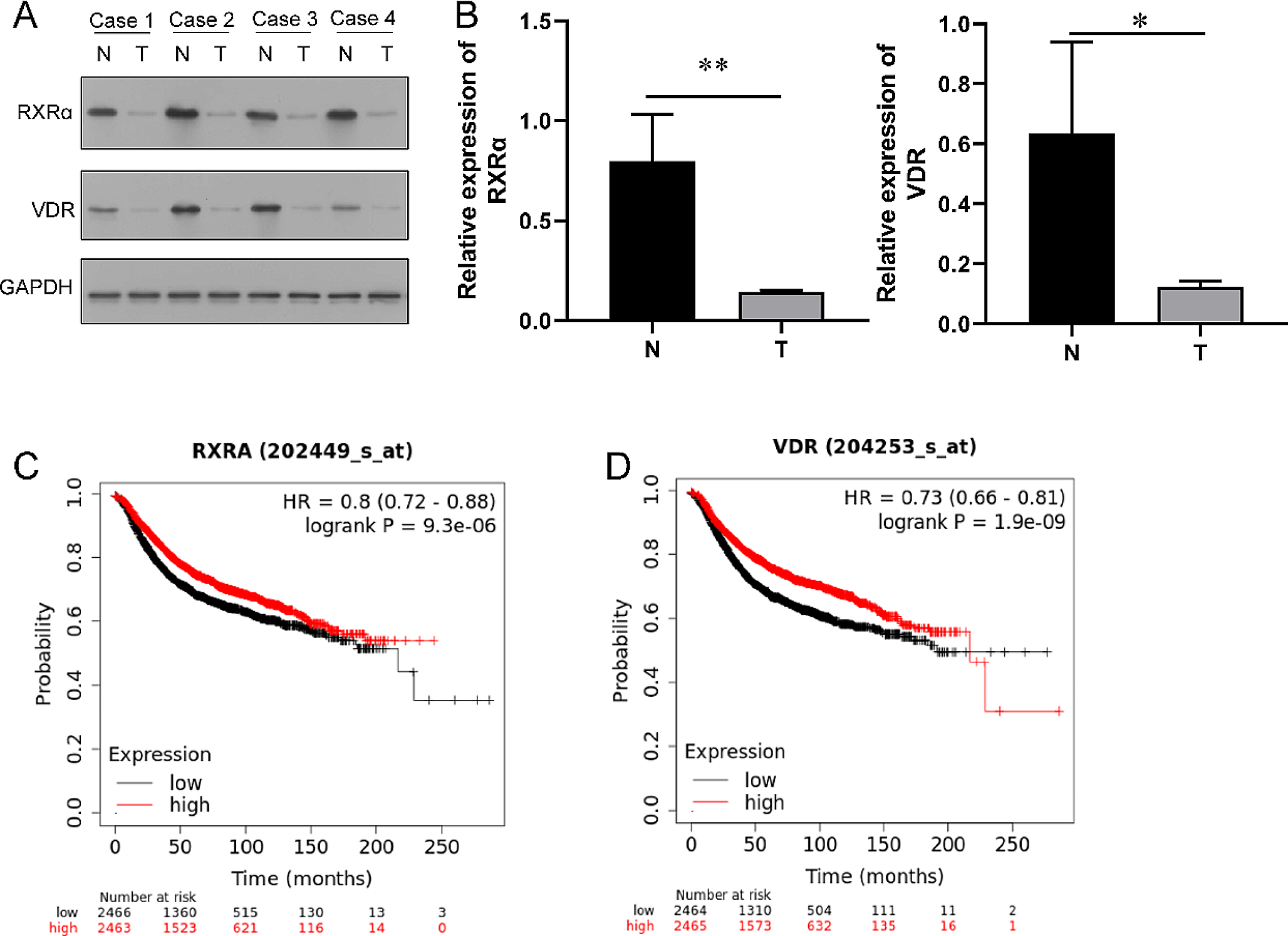 Vitamin D suppresses CD133+/CD44 + cancer stem cell stemness by inhibiting NF-κB signaling and reducing NLRP3 expression in triple-negative breast cancer