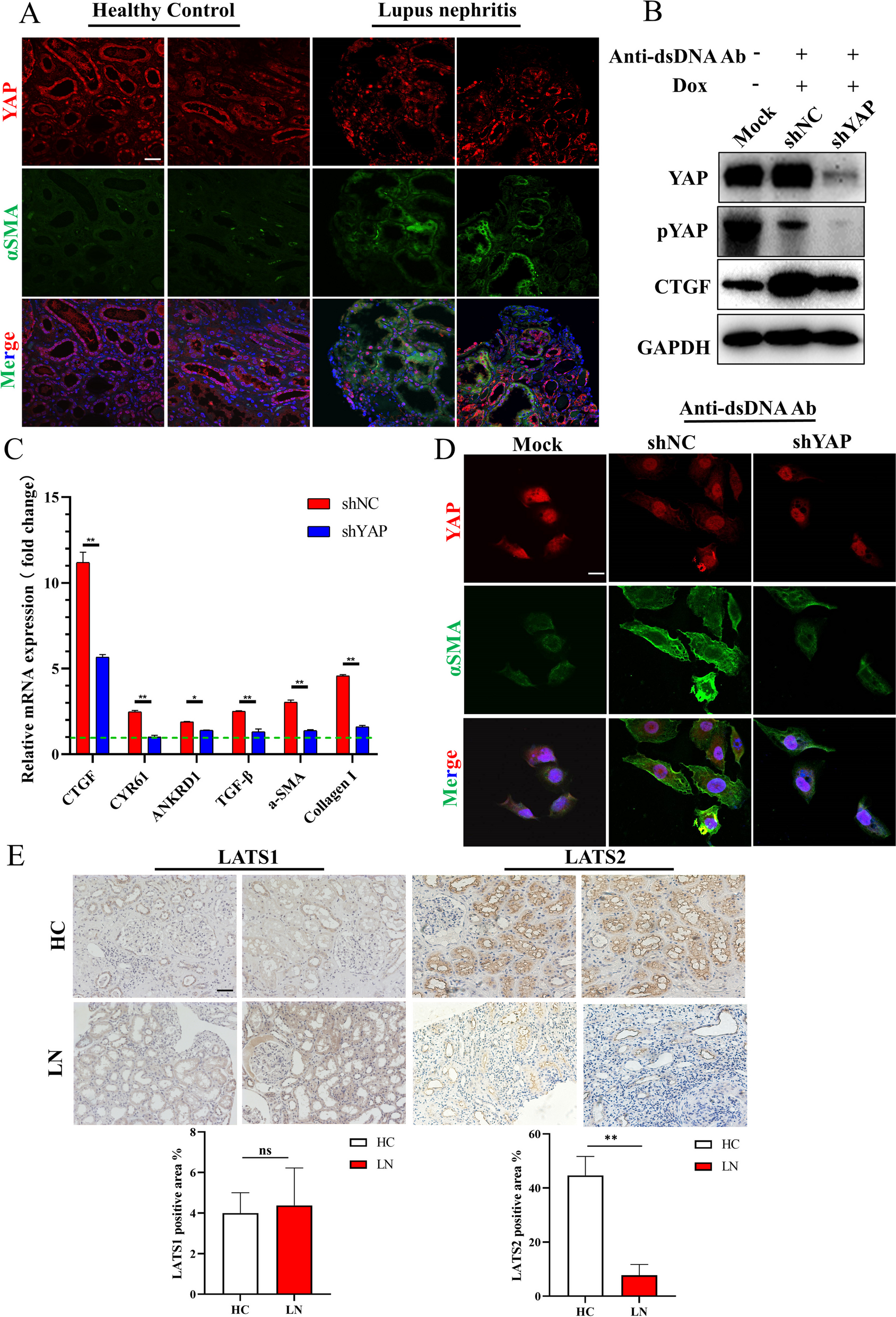 LATS2 degradation promoted fibrosis damage and rescued by vitamin K3 in lupus nephritis