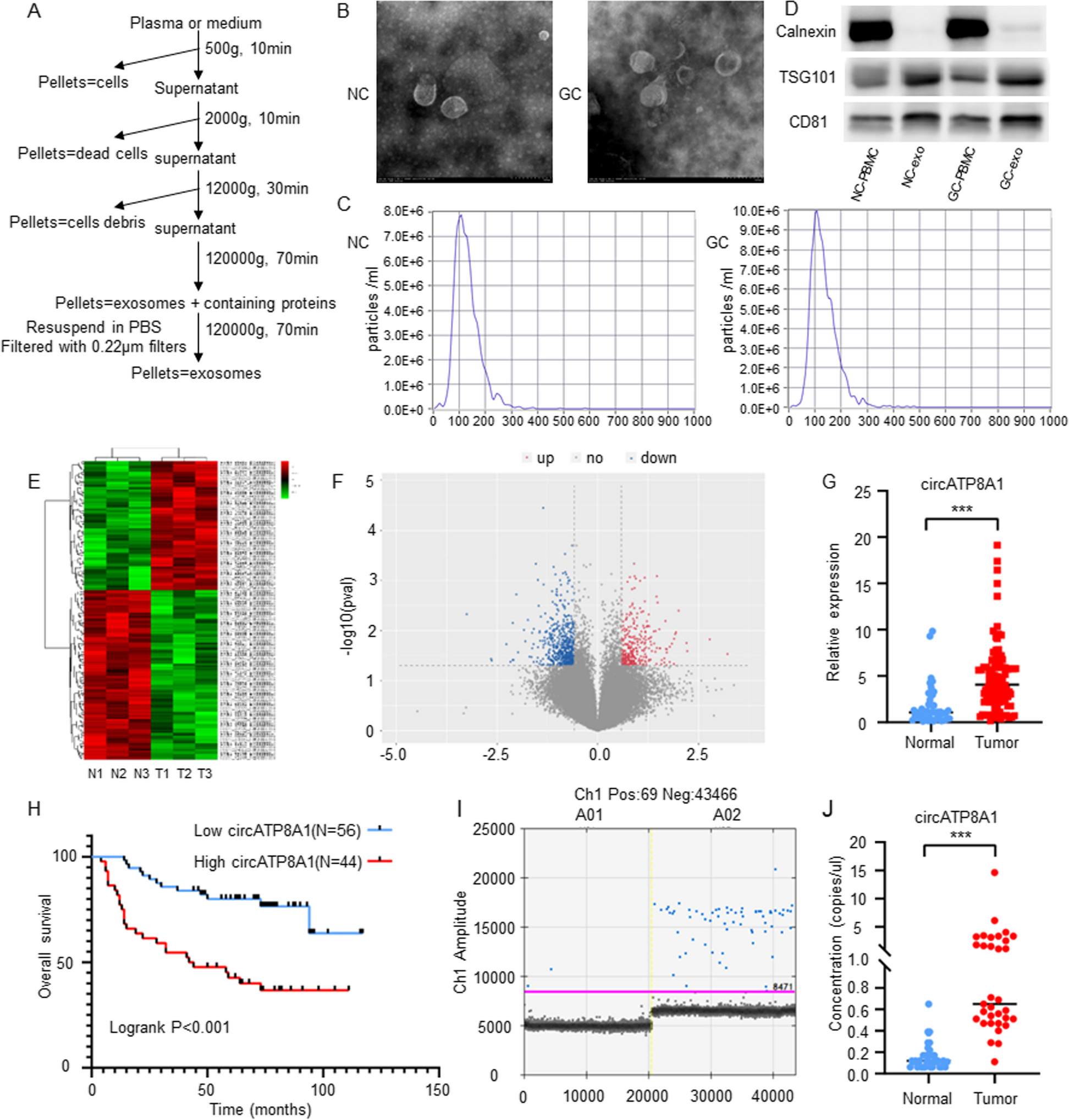 Exosome circATP8A1 induces macrophage M2 polarization by regulating the miR-1-3p/STAT6 axis to promote gastric cancer progression