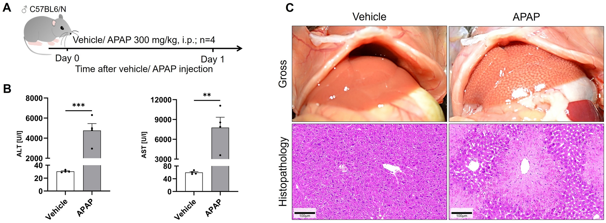 Acetaminophen overdose causes a breach of the blood–bile barrier in mice but not in rats