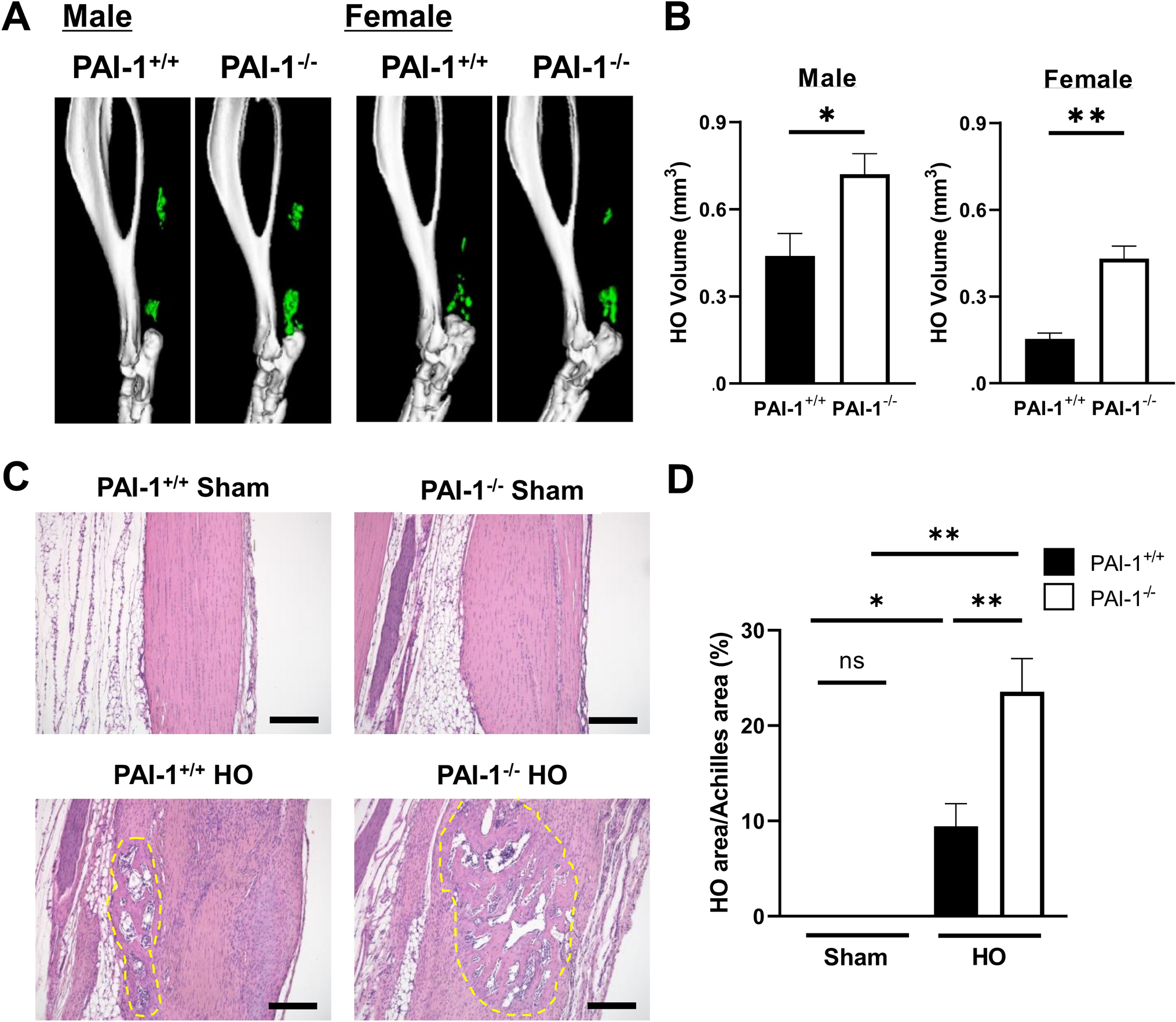 Roles of Plasminogen Activator Inhibitor-1 in Heterotopic Ossification Induced by Achilles Tenotomy in Thermal Injured Mice