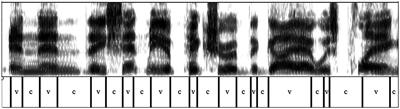 Analyzing changes in parkinsonian speech over time: a diachronic experimental phonetics study