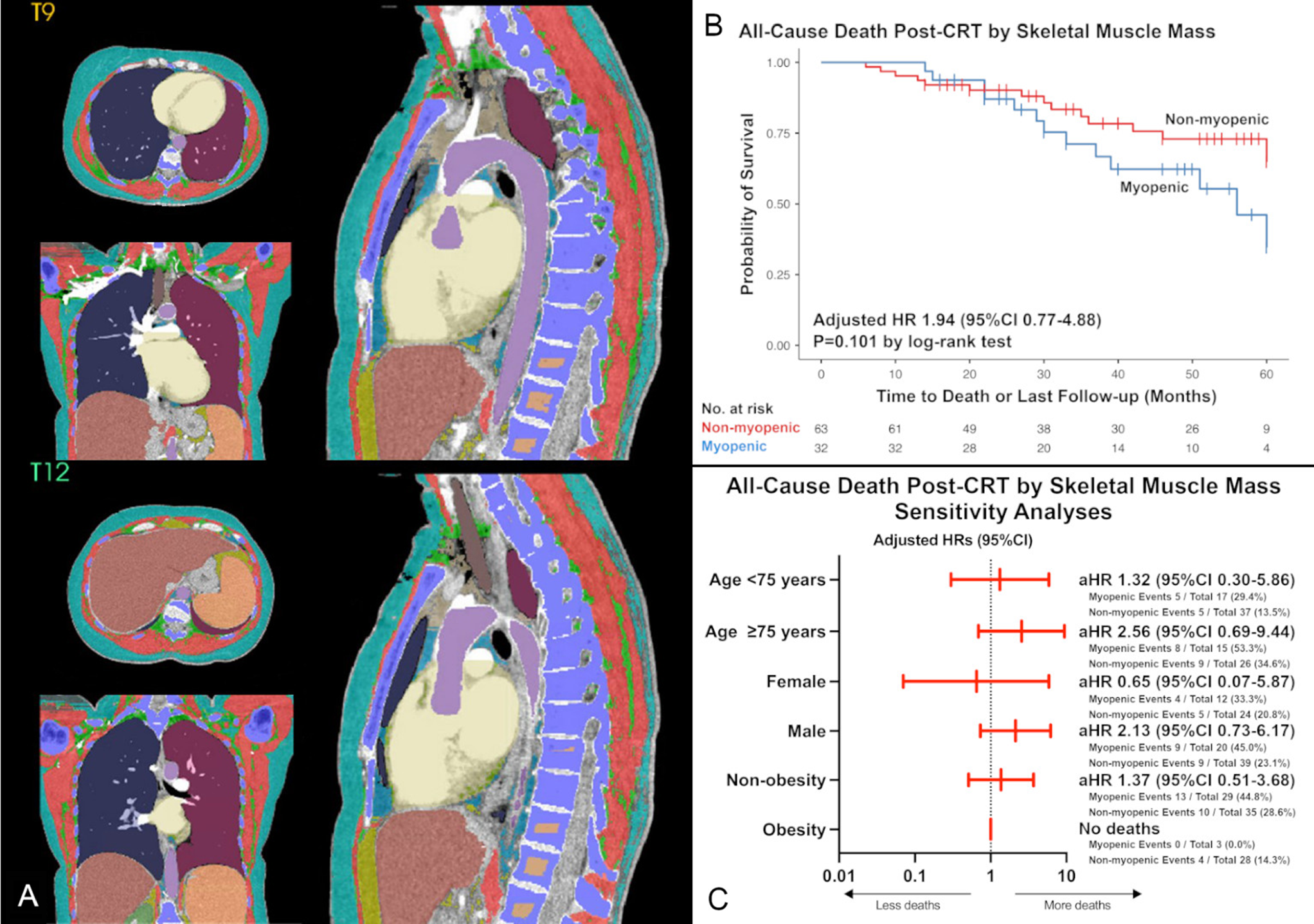 Preimplant myopenia and clinical outcomes among patients with heart failure undergoing cardiac resynchronization therapy
