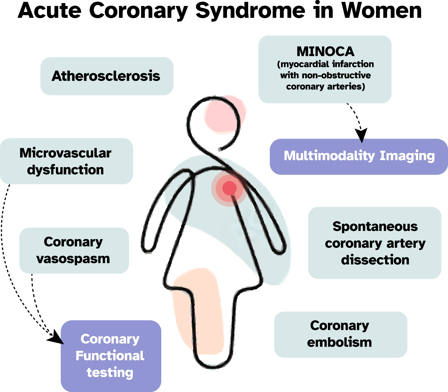 Acute Coronary Syndrome in Women: An Update