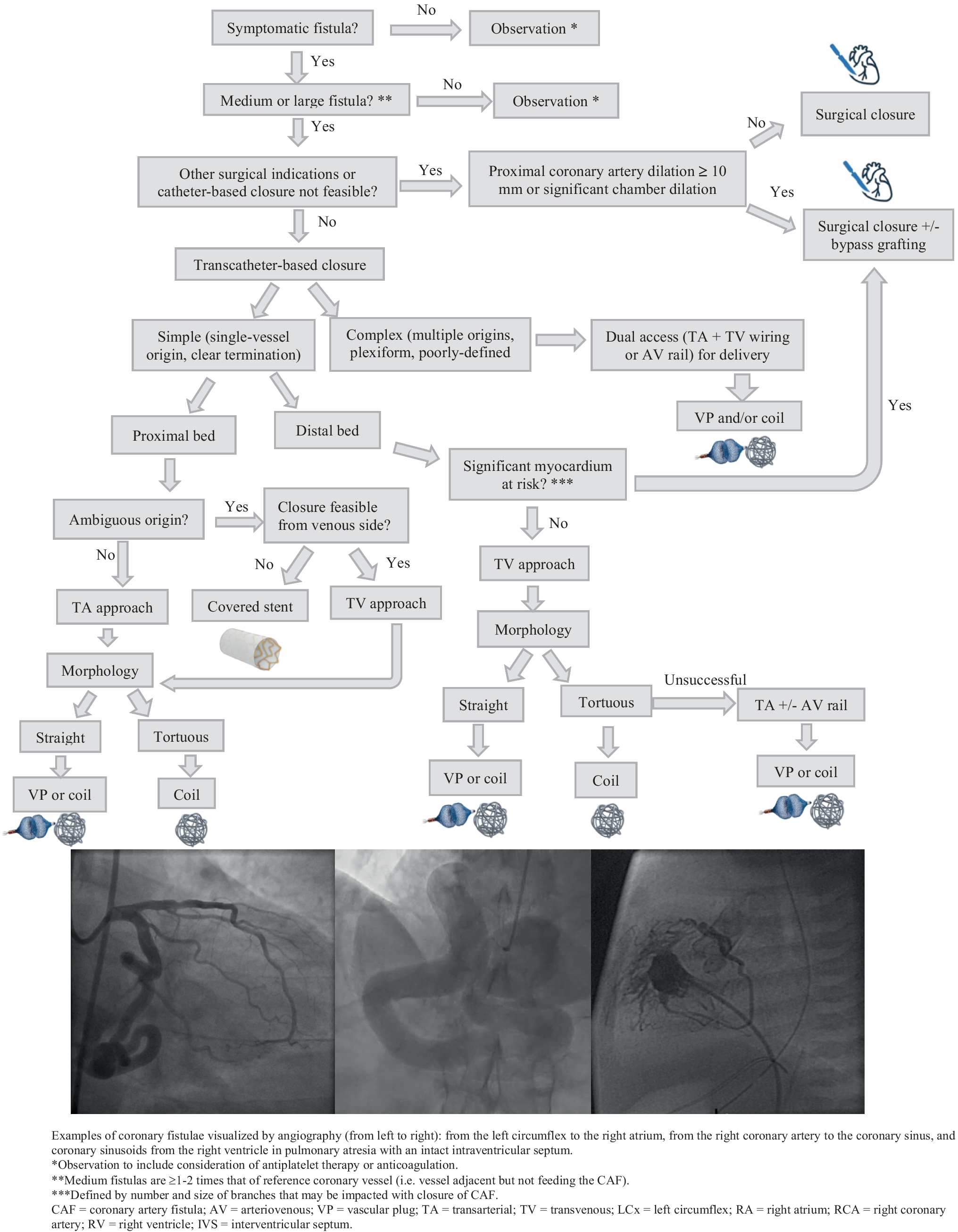 Diagnosis and Management of Congenital Coronary Artery Fistulas in Adults