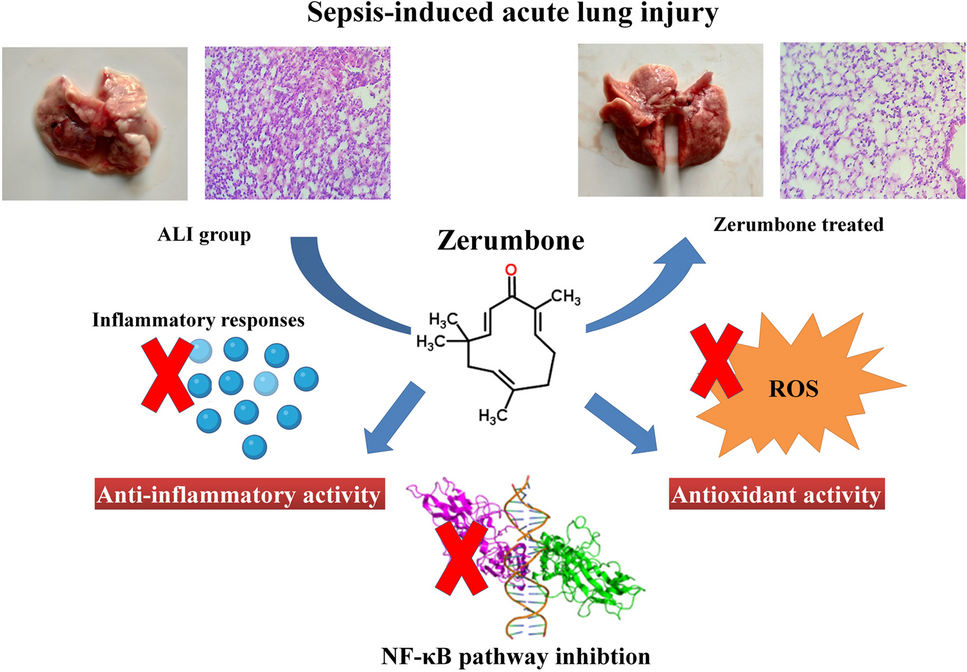 Protective effect of zerumbone on sepsis-induced acute lung injury through anti-inflammatory and antioxidative activity via NF-κB pathway inhibition and HO-1 activation