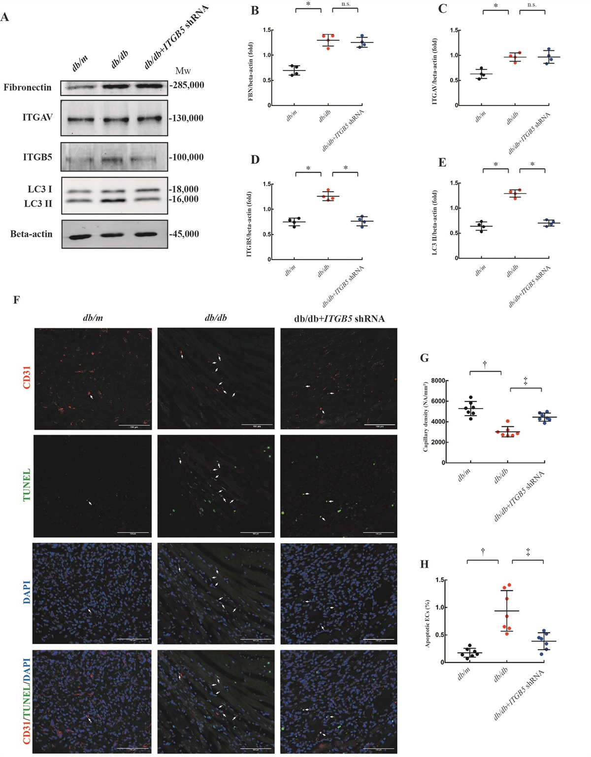Integrin β5 subunit regulates hyperglycemia-induced vascular endothelial cell apoptosis through FoxO1-mediated macroautophagy