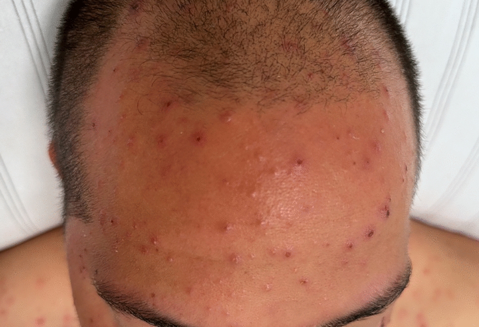Connecting the dots: spots on the skin, weakness within