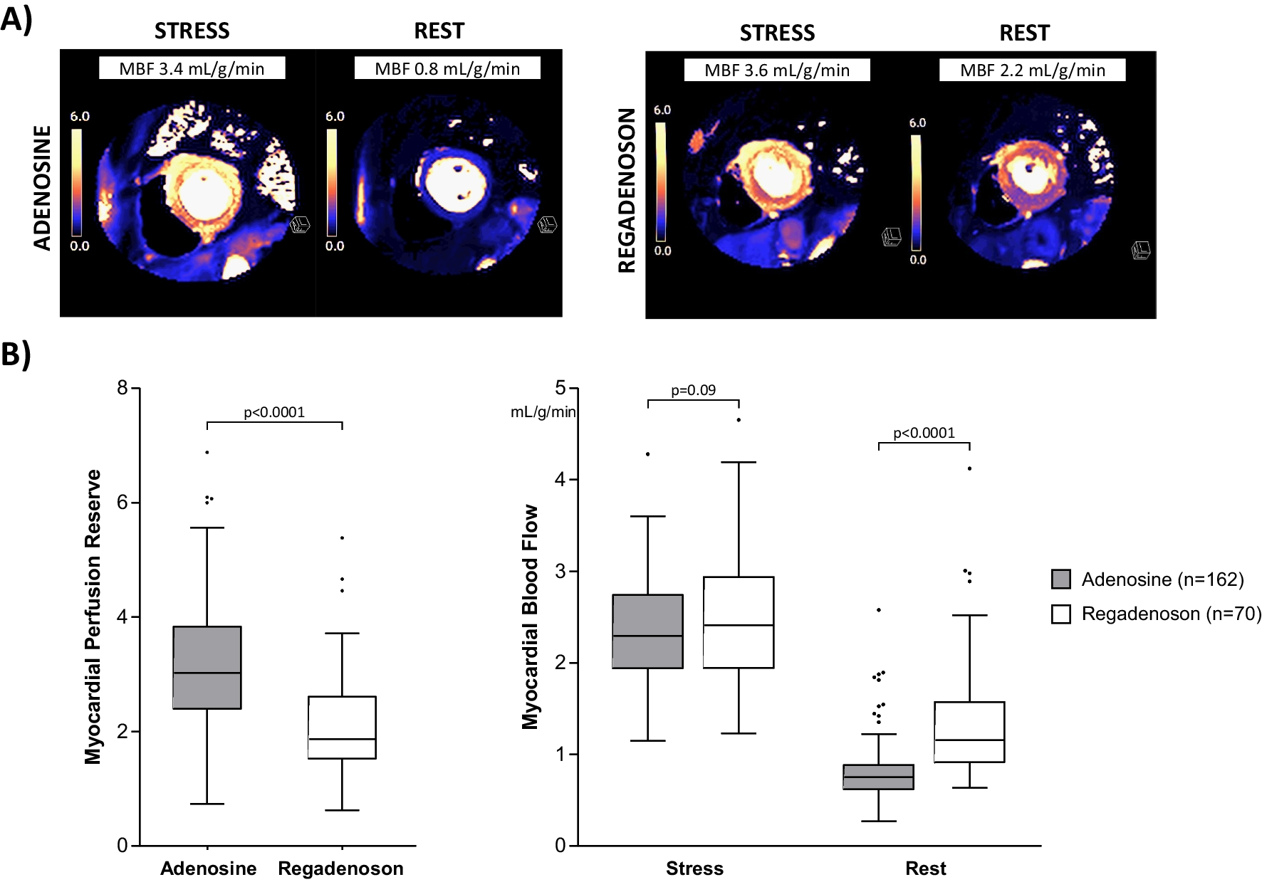 Systematic underestimation of myocardial perfusion reserve by regadenoson stress perfusion CMR—when haste makes waste