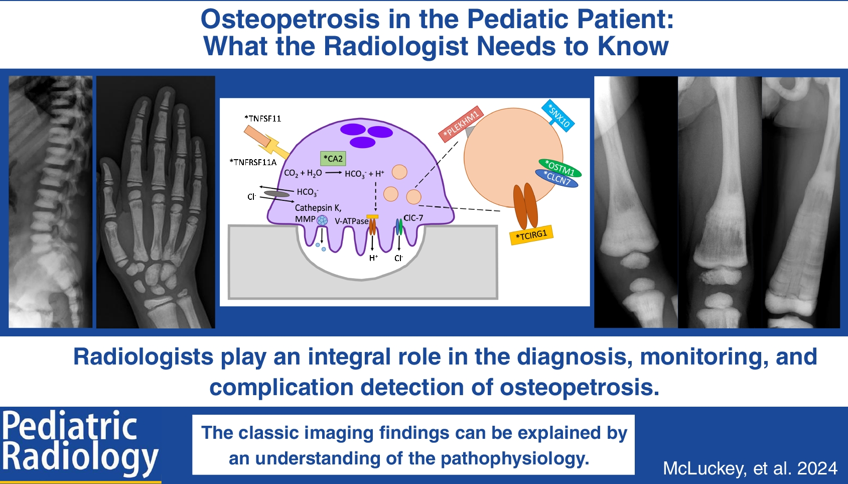 Osteopetrosis in the pediatric patient: what the radiologist needs to know