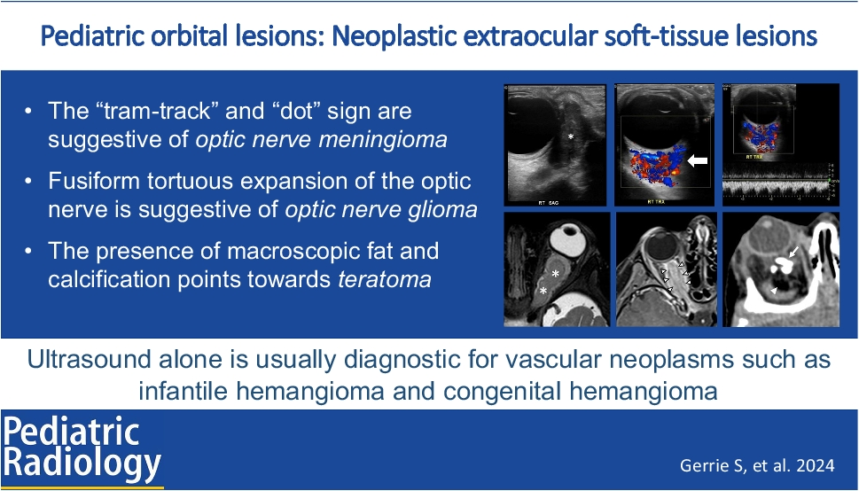 Pediatric orbital lesions: neoplastic extraocular soft-tissue lesions