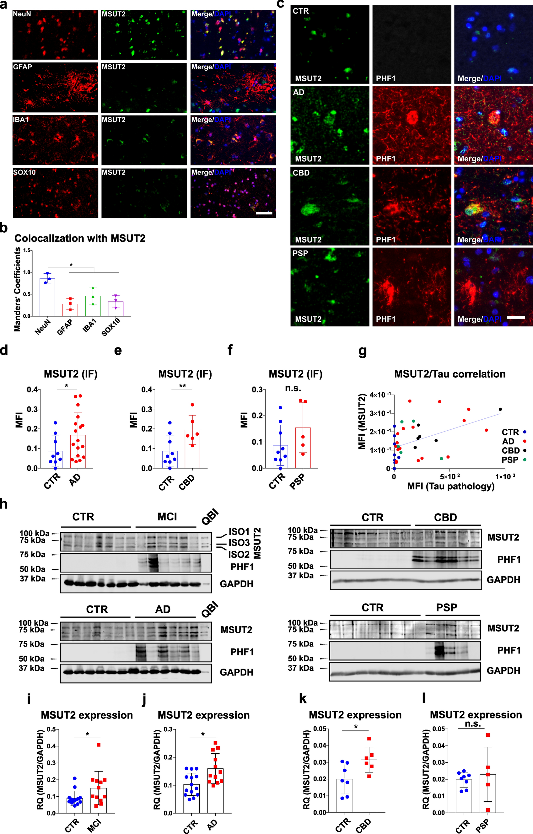 MSUT2 regulates tau spreading via adenosinergic signaling mediated ASAP1 pathway in neurons
