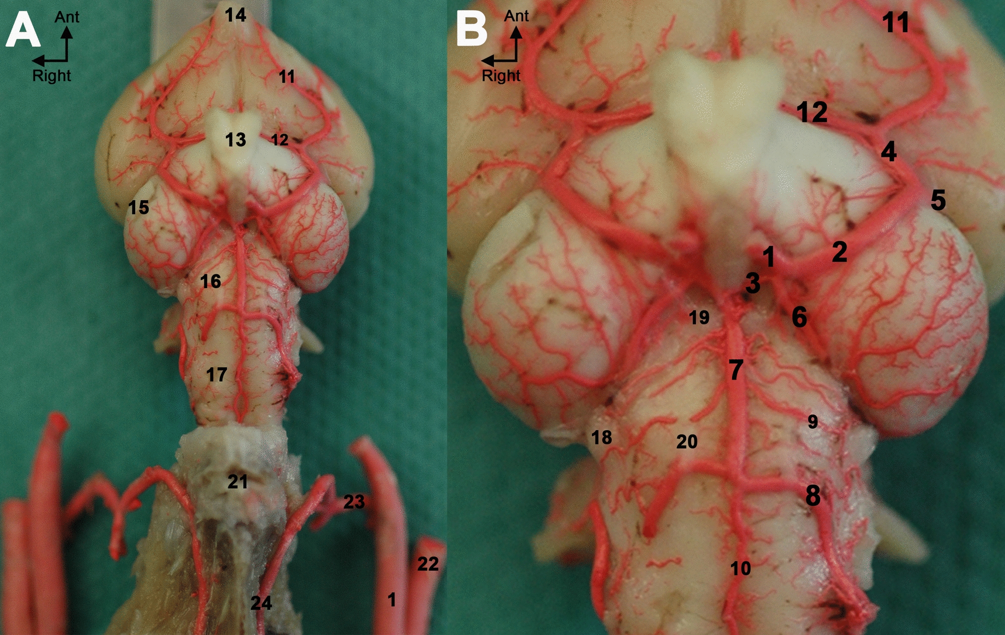Composition of encephalic arteries and origin of the basilar artery are different between vertebrates