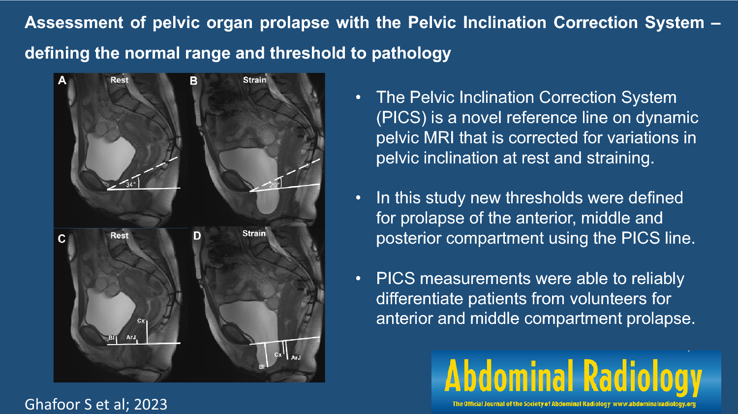 Assessment of pelvic organ prolapse with the Pelvic Inclination Correction System: defining the normal range and threshold to pathology