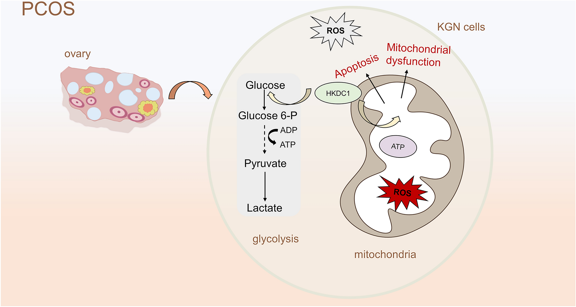 New insights into the treatment of polycystic ovary syndrome: HKDC1 promotes the growth of ovarian granulocyte cells by regulating mitochondrial function and glycolysis