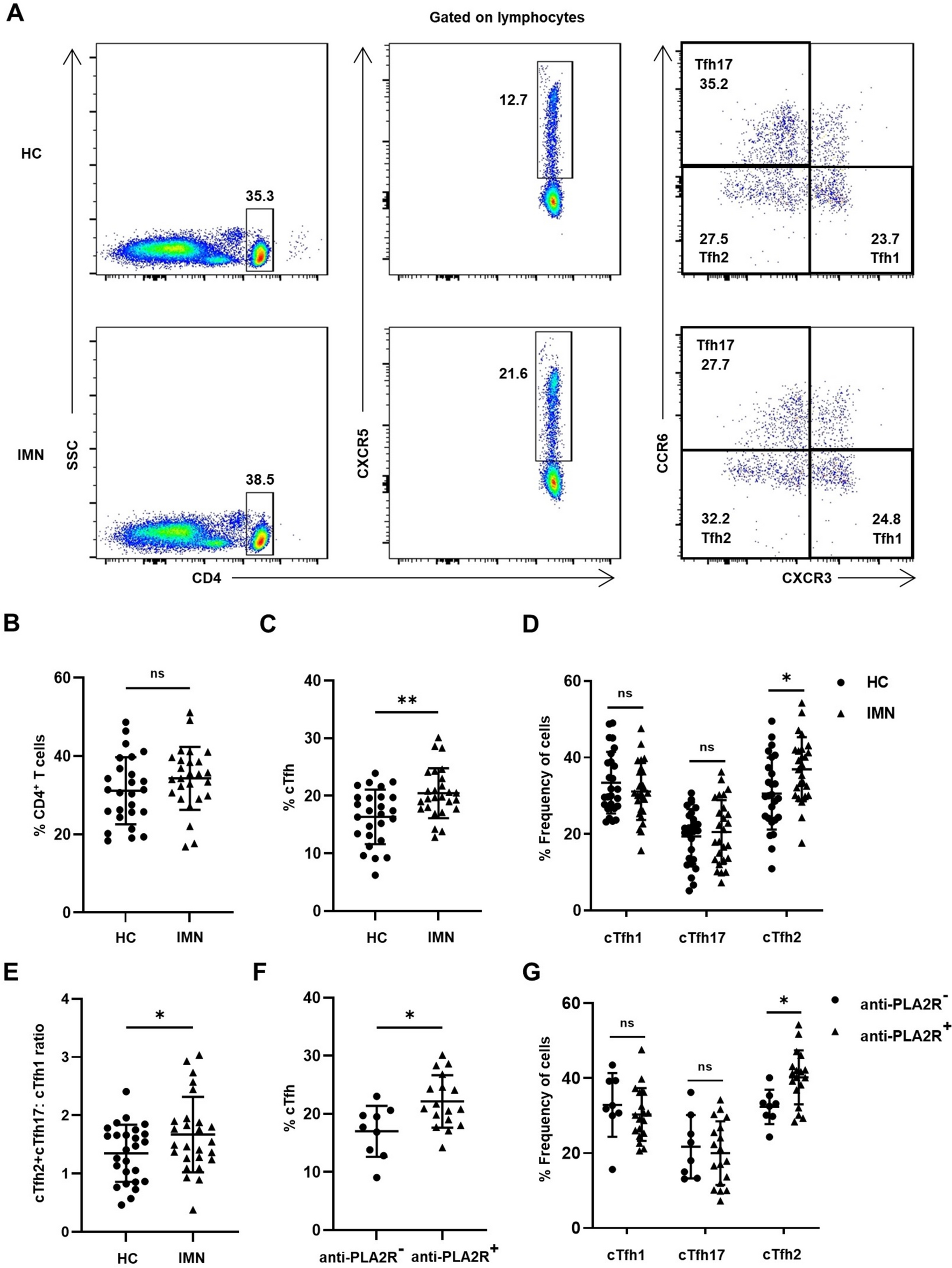 Imbalance of T follicular helper cell subsets trigger the differentiation of pathogenic B cells in idiopathic membranous nephropathy