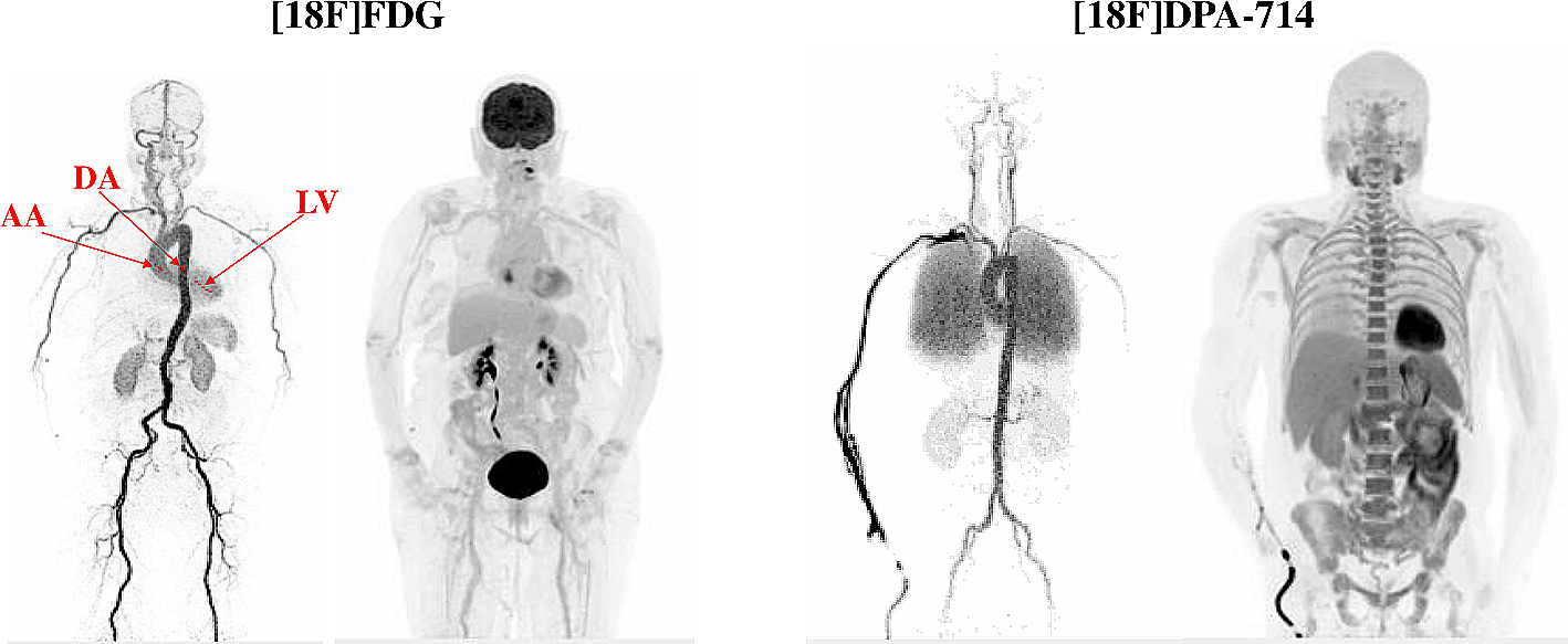 Validation of image-derived input function using a long axial field of view PET/CT scanner for two different tracers