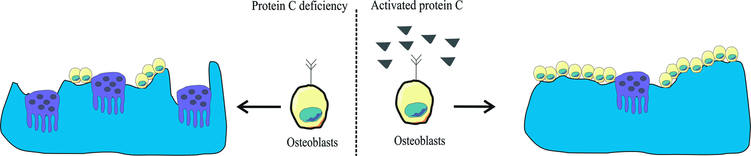 Deficiency of protein C or protein S as a possible cause of osteoporosis