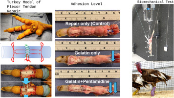 Pentamidine-loaded gelatin decreases adhesion formation of flexor tendon