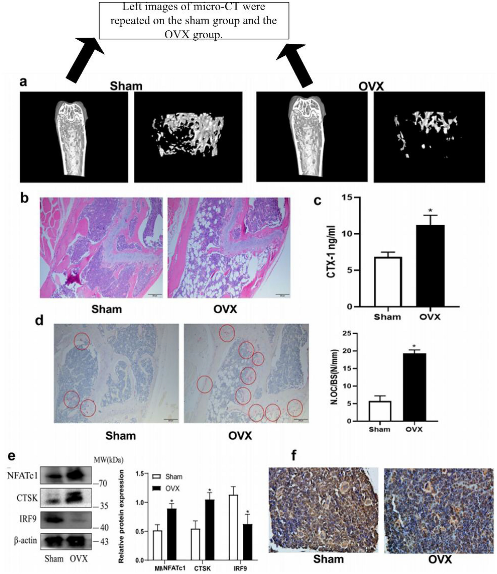 Author Correction: Suppression of IRF9 Promotes Osteoclast Differentiation by Decreased Ferroptosis via STAT3 Activation