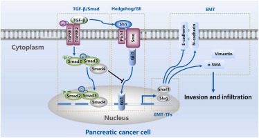 Smad4 regulates TGF-β1-mediated hedgehog activation to promote epithelial-to-mesenchymal transition in pancreatic cancer cells by suppressing Gli1 activity