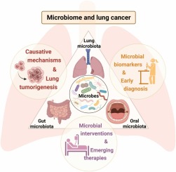 Microbiome and lung cancer: carcinogenic mechanisms, early cancer diagnosis, and promising microbial therapies