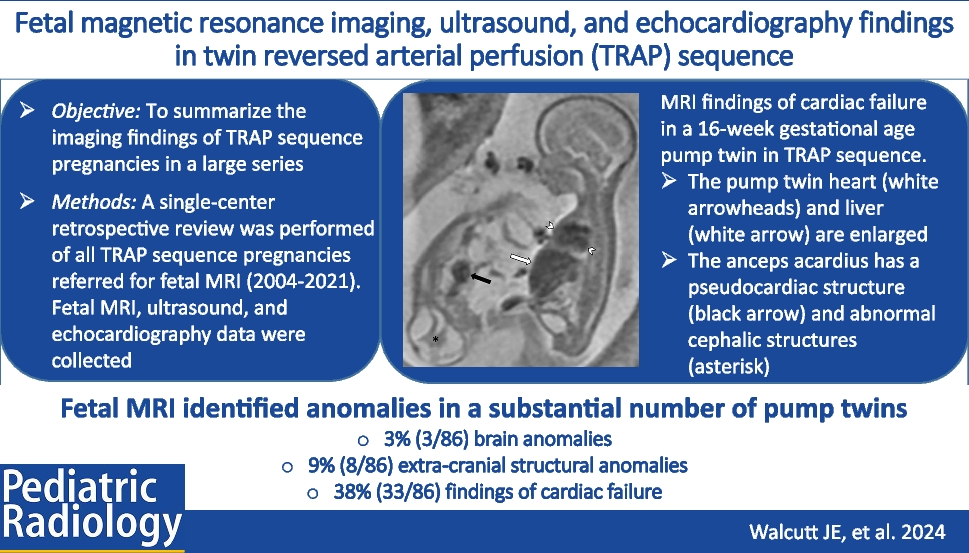 Fetal magnetic resonance imaging, ultrasound, and echocardiography findings in twin reversed arterial perfusion sequence