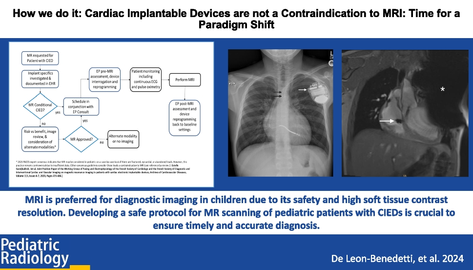 How we do it: Cardiac implantable devices are not a contraindication to MRI: time for a paradigm shift