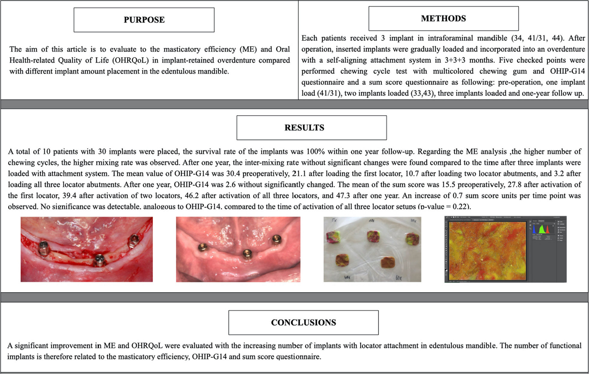 Evaluation of masticatory efficiency and OHRQoL in implant-retained overdenture with different numbers of implant in the edentulous mandible: a one-year follow-up prospective study