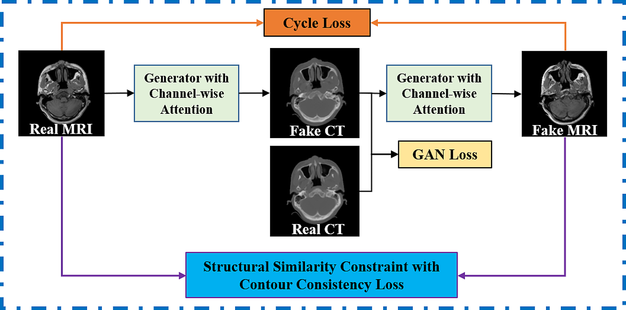Channel-wise attention enhanced and structural similarity constrained cycleGAN for effective synthetic CT generation from head and neck MRI images