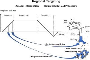 Regional lung targeting with a fluticasone/salmeterol aerosol using a bolus breath hold method of the PreciseInhale® system: A first evaluation in humans