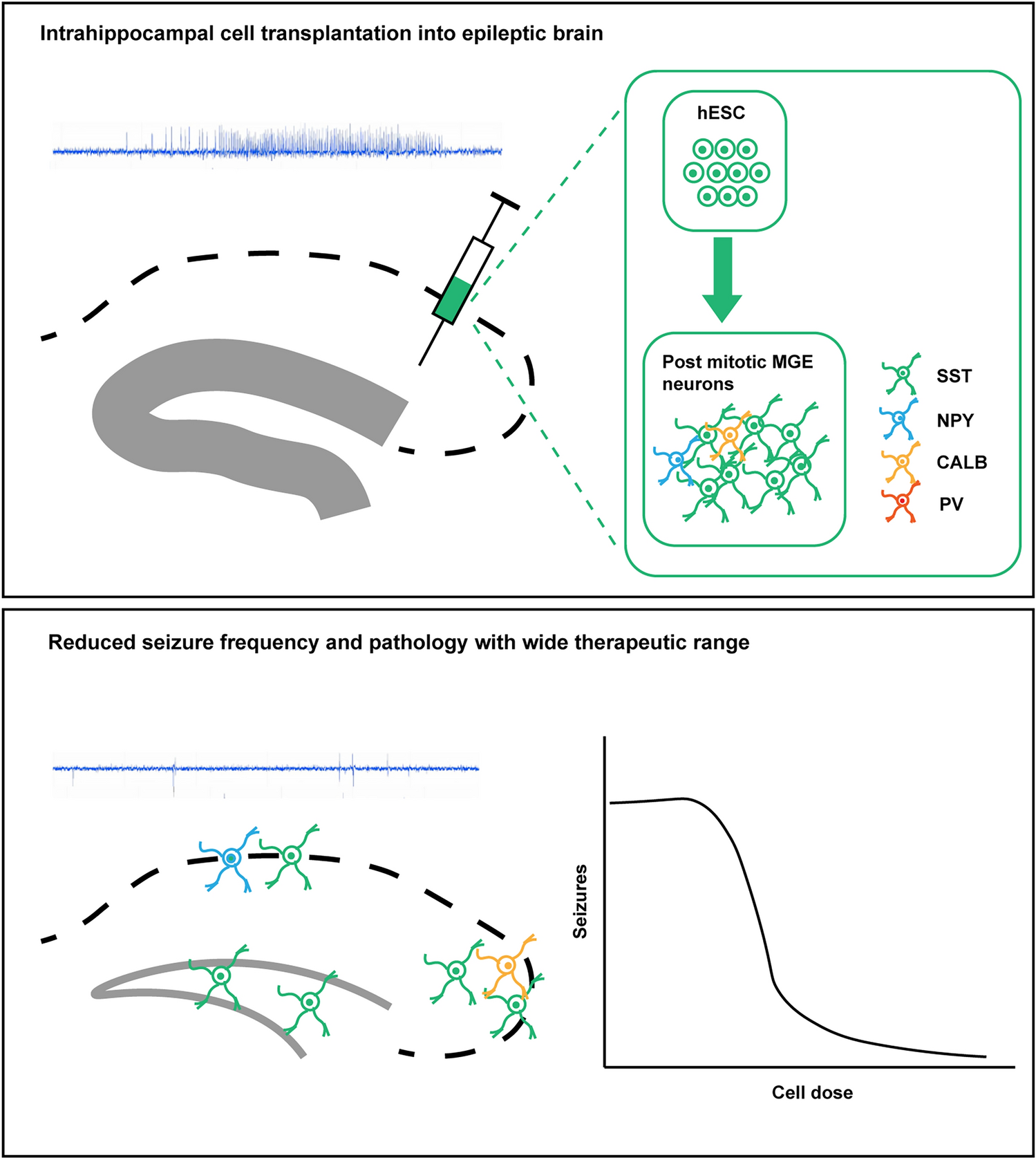 GABAergic Interneuron Cell Therapy for Drug-Resistant Epilepsy