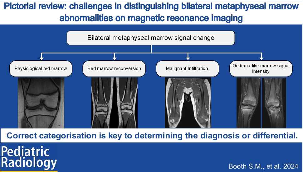 Pictorial review: challenges in distinguishing bilateral metaphyseal marrow abnormalities on magnetic resonance imaging