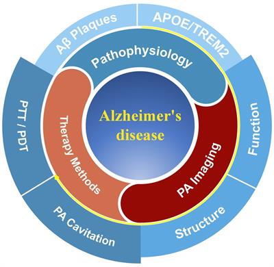 Light on Alzheimer's disease: from basic insights to preclinical studies