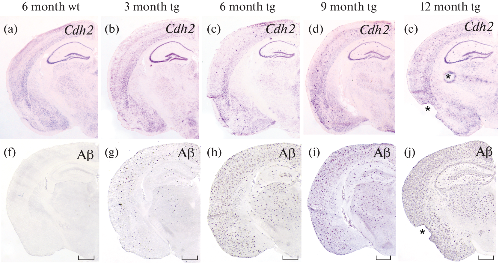 Application of Cadherin cRNA Probes in Brains of Alzheimer’s Disease Mouse Model
