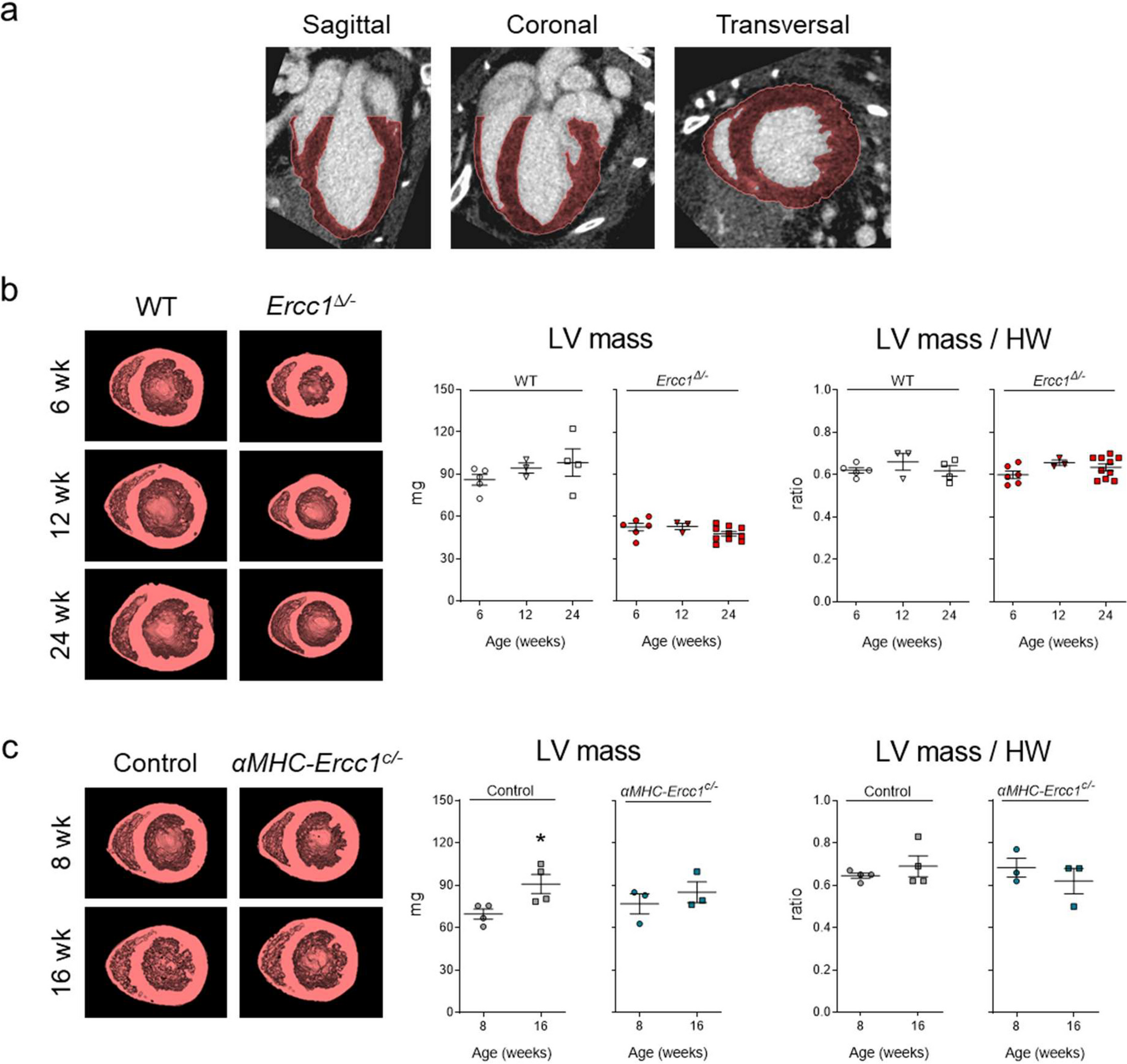 Hybrid Molecular and Functional Micro-CT Imaging Reveals Increased Myocardial Apoptosis Preceding Cardiac Failure in Progeroid Ercc1 Mice