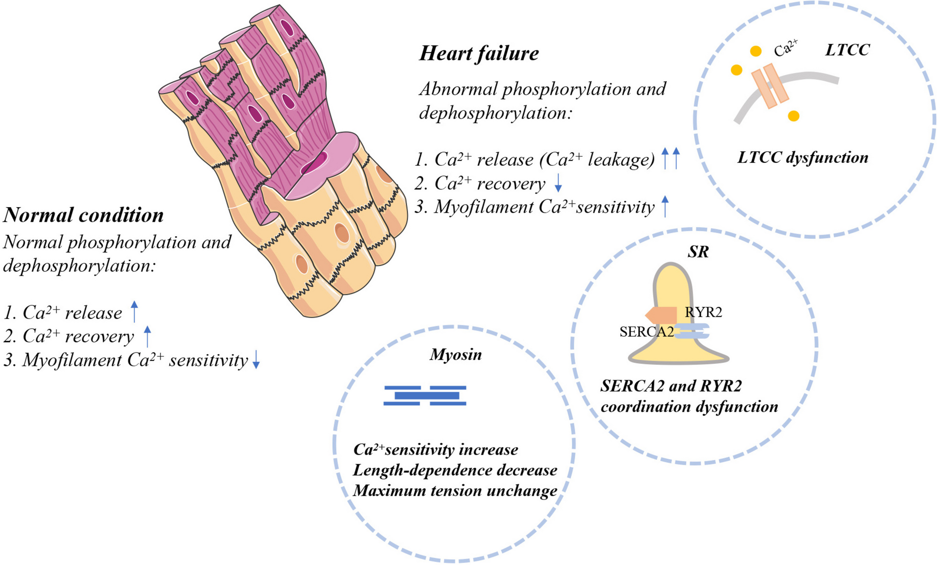 Abnormal phosphorylation / dephosphorylation and Ca2+ dysfunction in heart failure