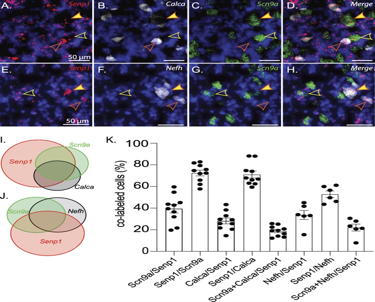 Targeted transcriptional upregulation of SENP1 by CRISPR activation enhances deSUMOylation pathways to elicit antinociception in the spinal nerve ligation model of neuropathic pain