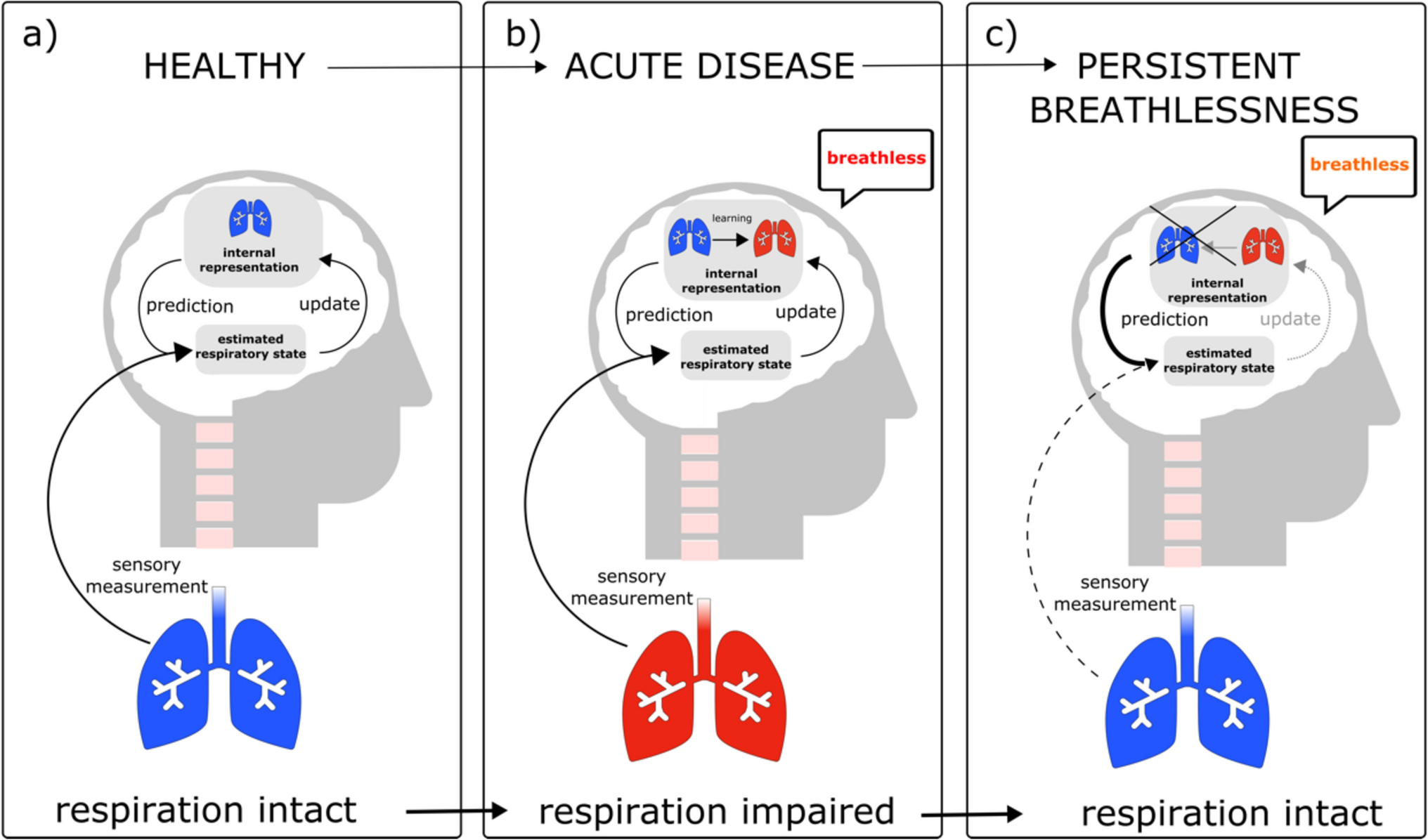 Post-COVID breathlessness: a mathematical model of respiratory processing in the brain