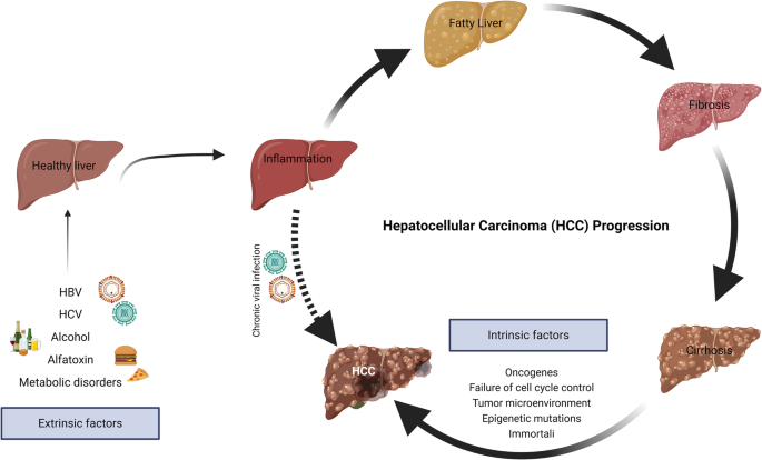 Heterogeneity of hepatocellular carcinoma: from mechanisms to clinical implications