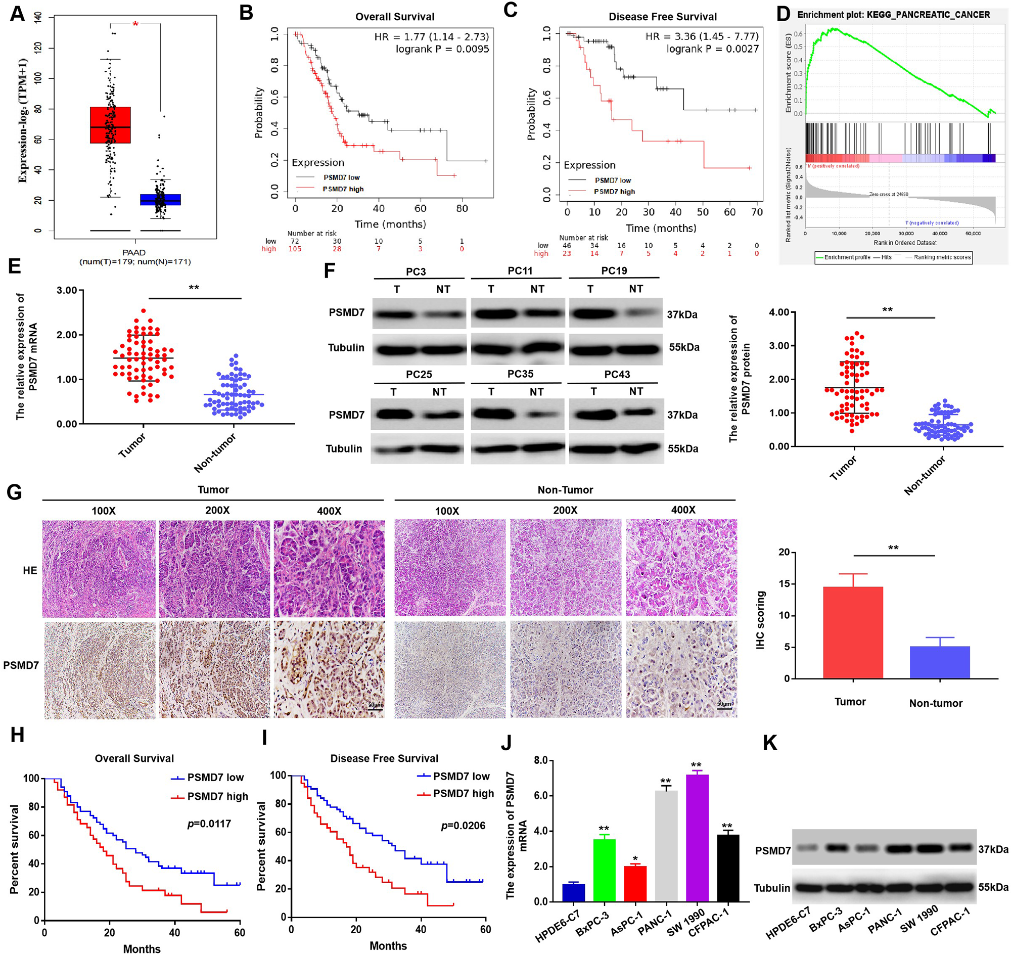 Deubiquitinase PSMD7 facilitates pancreatic cancer progression through activating Nocth1 pathway via modifying SOX2 degradation
