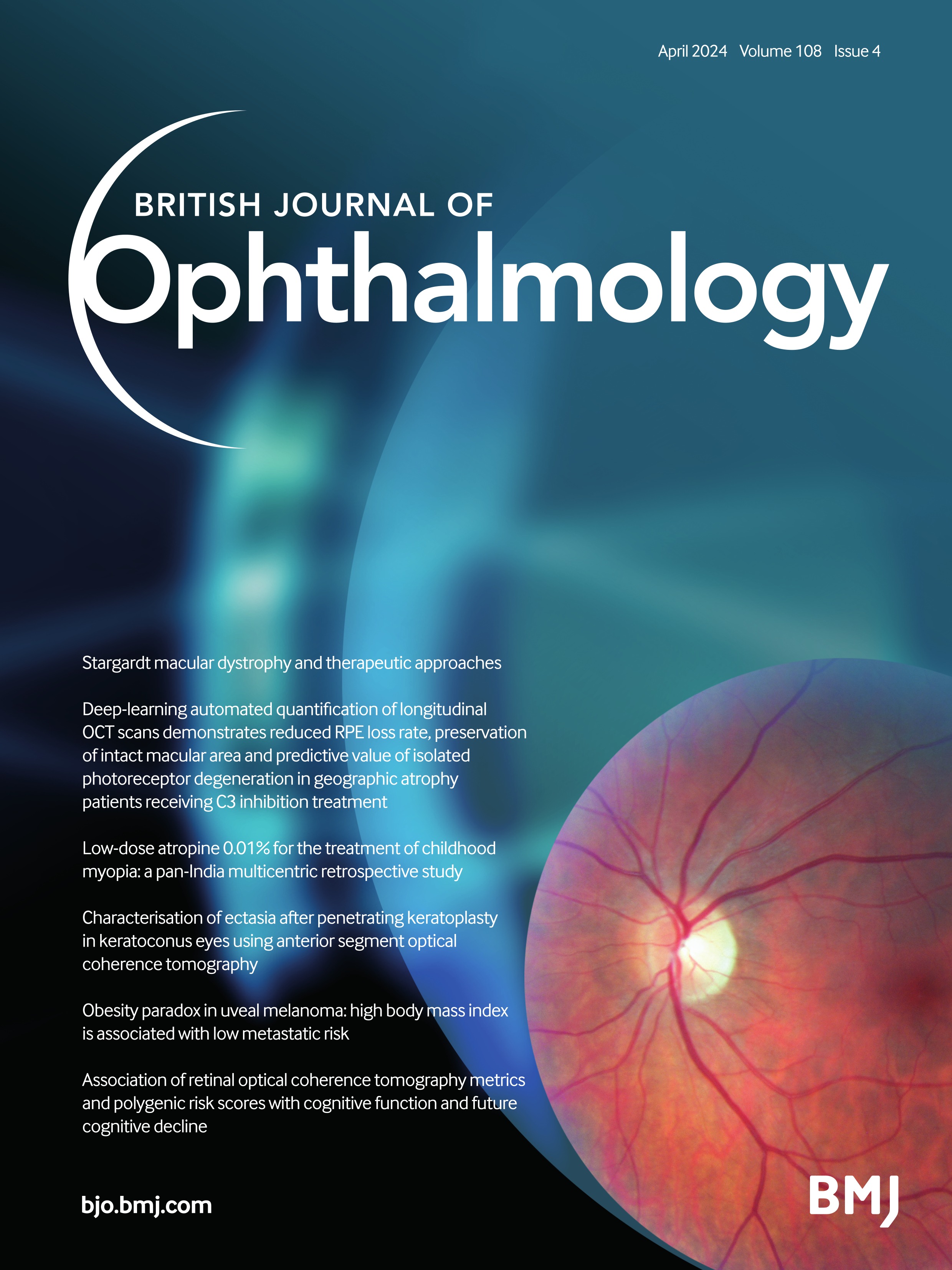 Risk factors for cataract in retinoblastoma management
