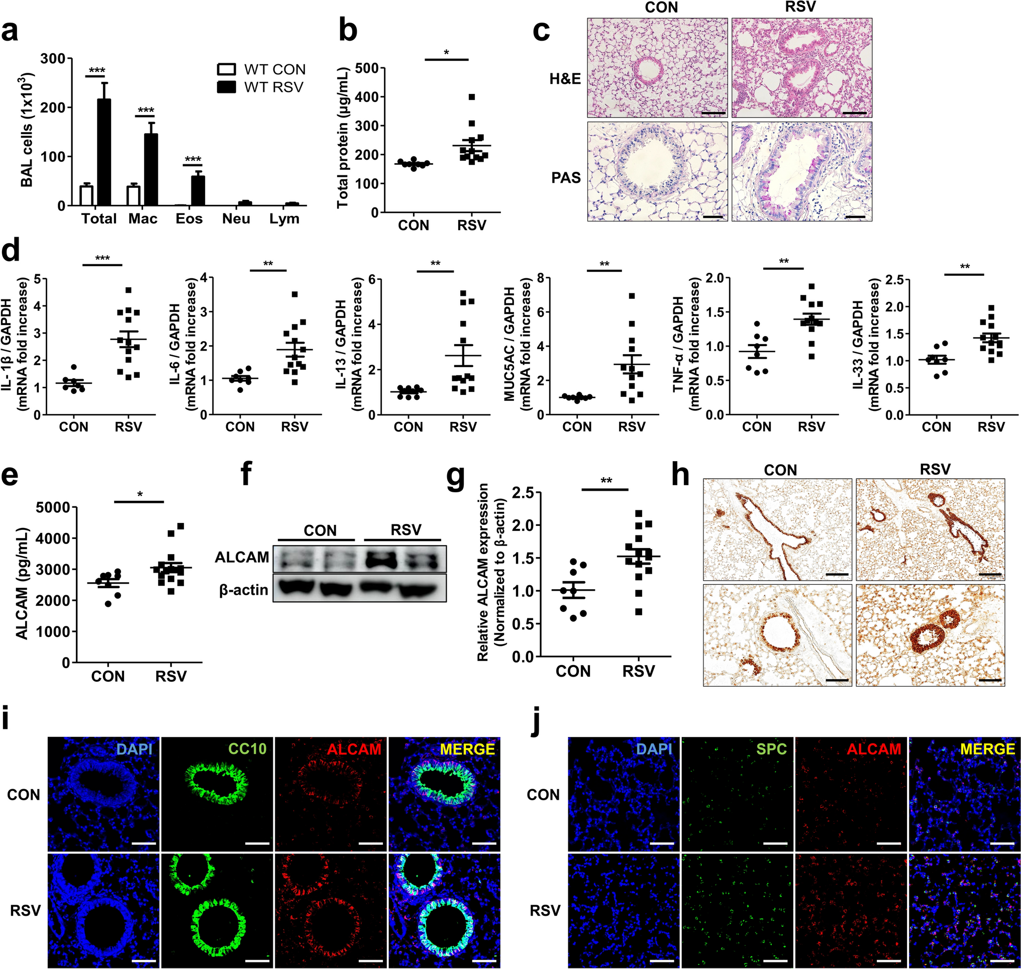 Activated Leukocyte Cell Adhesion Molecule Regulates the Expression of Interleukin-33 in RSV Induced Airway Inflammation by Regulating MAPK Signaling Pathways