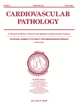 Subclinical Maternal Autoimmune Disease Leading to Congenital High Degree Atrioventricular Block: Case Report and Review of the Literature