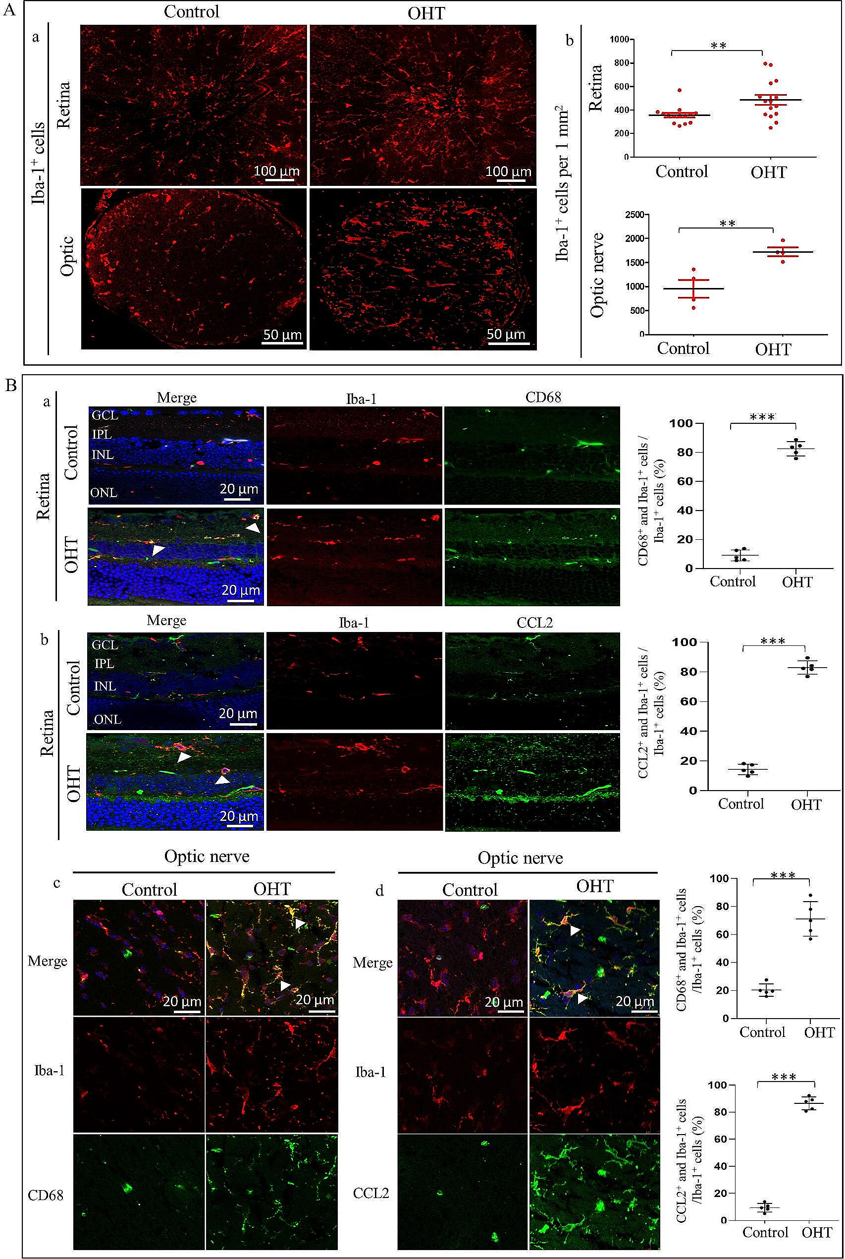 Human adipose tissue-derived stem cell extracellular vesicles attenuate ocular hypertension-induced retinal ganglion cell damage by inhibiting microglia- TLR4/MAPK/NF-κB proinflammatory cascade signaling