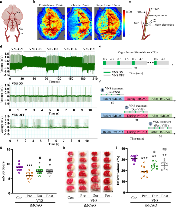 Vagus nerve stimulation as a promising neuroprotection for ischemic stroke via α7nAchR-dependent inactivation of microglial NLRP3 inflammasome