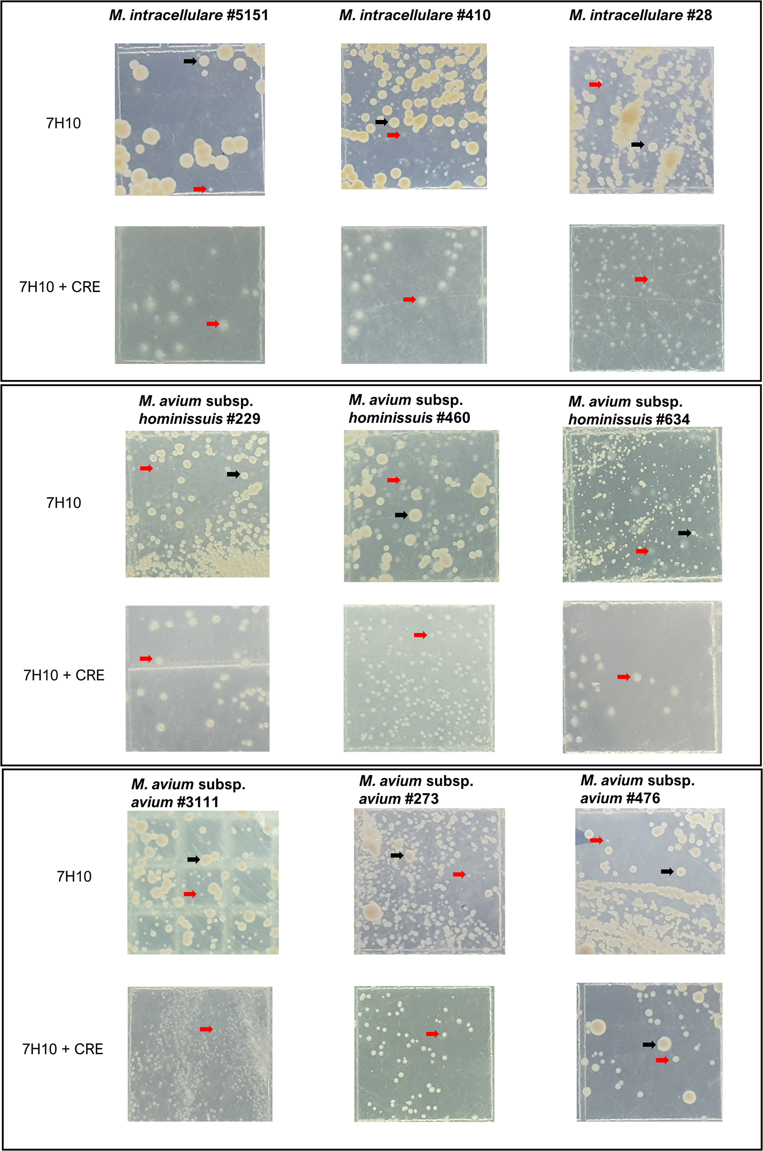 Bigger problems from smaller colonies: emergence of antibiotic-tolerant small colony variants of Mycobacterium avium complex in MAC-pulmonary disease patients